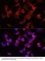 SERPINA1 Antibody