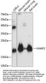 VAMP2 Antibody