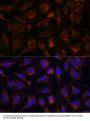 Akt2 Antibody