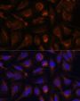 Akt2 Antibody