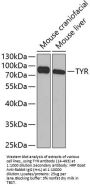 TYR Antibody