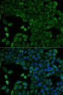 SLC25A13 Antibody