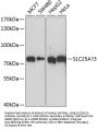 SLC25A13 Antibody