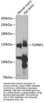 TOPBP1 Antibody