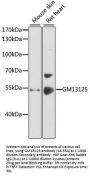 GM13125 Antibody