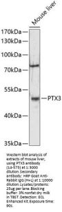 PTX3 Antibody