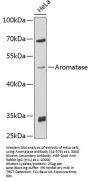 Aromatase Antibody