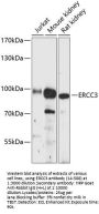 ERCC3 Antibody