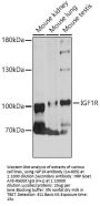 IGF1R Antibody
