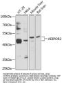 ADIPOR2 Antibody