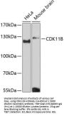CDK11B Antibody