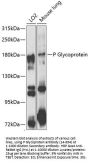 P Glycoprotein Antibody