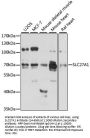 SLC27A1 Antibody