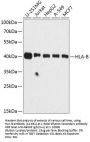 HLA-B Antibody