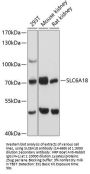 SLC6A18 Antibody