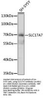 SLC17A7 Antibody