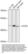 KCNJ2 Antibody