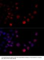 HNRNPH2 Antibody