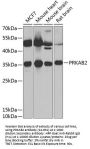 PRKAB2 Antibody