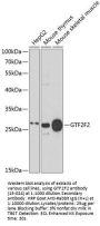 GTF2F2 Antibody