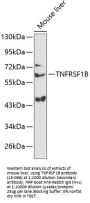 TNFRSF1B Antibody