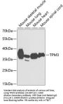 TPM3 Antibody