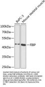 FIBP Antibody