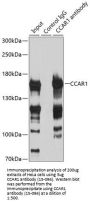 CCAR1 Antibody