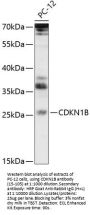 CDKN1B Antibody