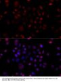 VDAC1 / Porin Antibody