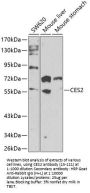 CES2 Antibody