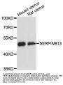 SERPINB13 Antibody