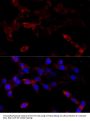 CYP1B1 Antibody