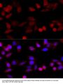 CYP1B1 Antibody