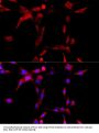 CYP1B1 Antibody