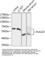 PLA2G7 Antibody