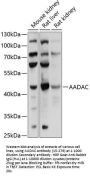 AADAC Antibody