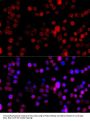 CYP1B1 Antibody