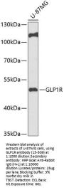 GLP1R Antibody