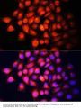 IGF2 Antibody