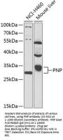PNP Antibody