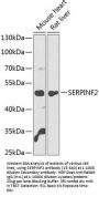 SERPINF2 Antibody