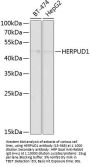 HERPUD1 Antibody