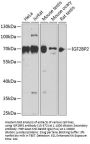 IGF2BP2 Antibody