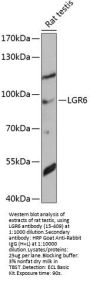 LGR6 Antibody