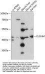 CLEC4M Antibody