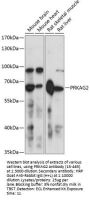 PRKAG2 Antibody