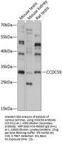 CCDC59 Antibody