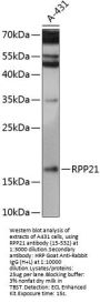 RPP21 Antibody
