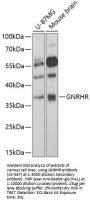 GNRHR Antibody